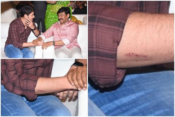 Mahesh Babu with Chiranjeevi and his injured hand photos Mahesh Babu with Chiranjeevi and his injured hand photos