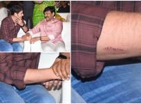 Mahesh Babu with Chiranjeevi and his injured hand photos