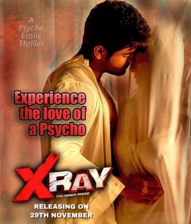 X Ray