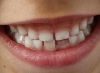 Teeth