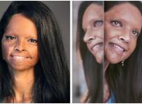 Deepika Padukone Chhapaak