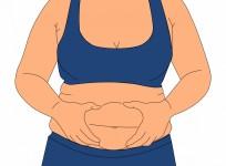 obesity
