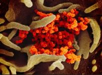 Coronavirus image