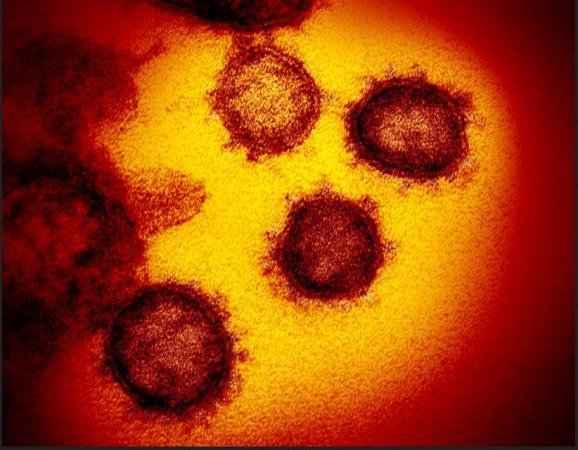 This transmission electron microscope image shows SARS-CoV-2—also known as 2019-nCoV, the virus that causes COVID-19. isolated from a patient in the U.S., emerging from the surface of cells cultured in the lab. coronavirus