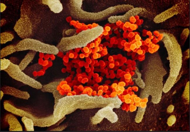 This scanning electron microscope image shows SARS-CoV-2 (orange)—also known as 2019-nCoV, the virus that causes COVID-19—isolated from a patient in the U.S., emerging from the surface of cells (green) cultured in the lab. Coronavirus
