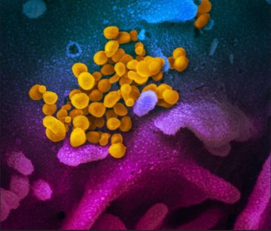 This scanning electron microscope image shows SARS-CoV-2 (yellow)—also known as 2019-nCoV, the virus that causes COVID-19—isolated from a patient in the U.S., emerging from the surface of cells (blue/pink) cultured in the lab. coronavirus