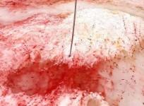 Antarctica's snow turns blood red