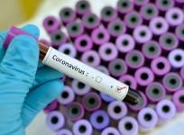 Coronavirus study