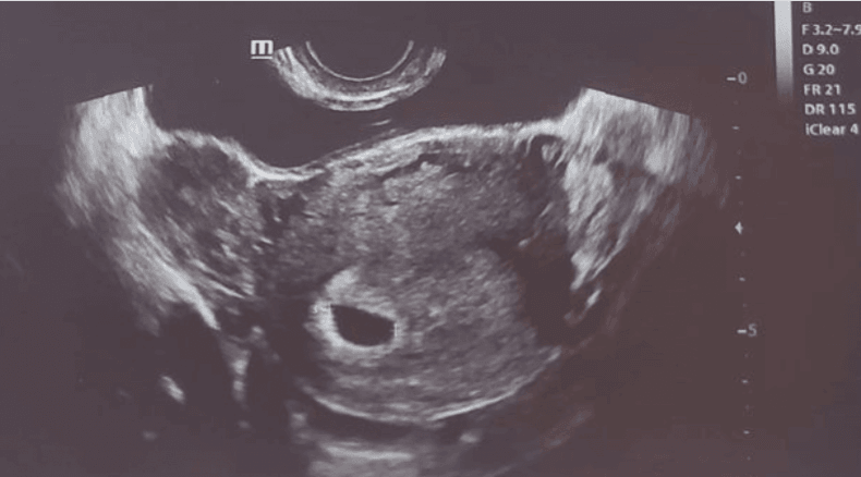 Amanda Bynes posted ultrasound and then deleted it Amanda Bynes