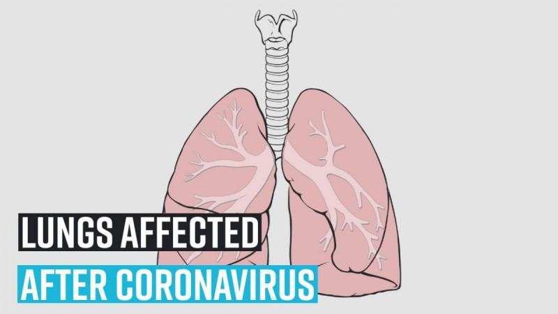 What happens to the lungs after getting affected by the Coronavirus?