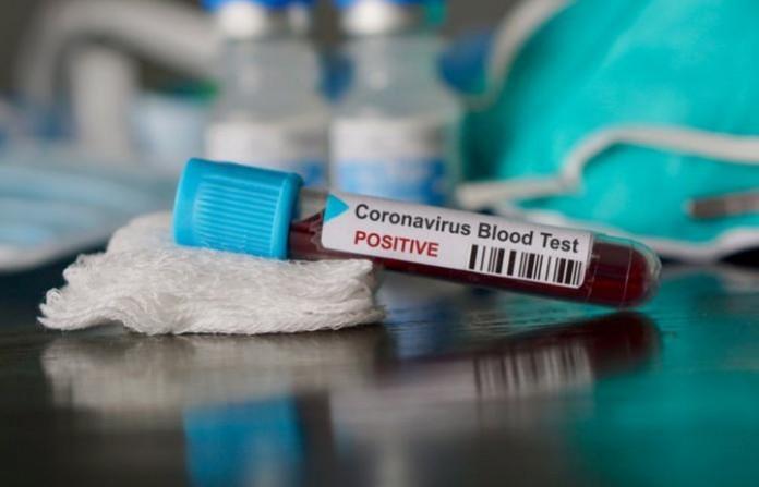 Punjab's 1st COVID-19 casualty, a 70-year old priest, infected 23 others Punjab's 1st COVID-19 casualty, a 70-year old priest, infected 23 others