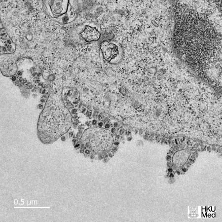 virus cell replication