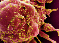 SARS-COV-2 virus