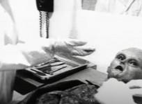 alien autopsy