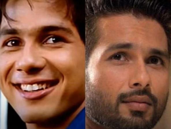 Shahid Kapoor: Before and after plastic surgery Shahid Kapoor cosmetic surgery