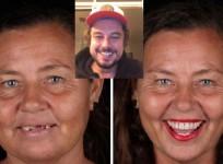 Brazilian Dentist traveling around world to fix teeth of poor for free