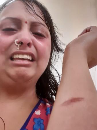 Indian woman pleads for help against domestic abuse 穆斯林家庭的帮助是为了防止她的利益