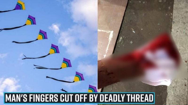A boy riding his scooter suffered a Chinese manjha injury where his fingers were cut off by the deadly thread. Man's fingers cut off by deadly thread