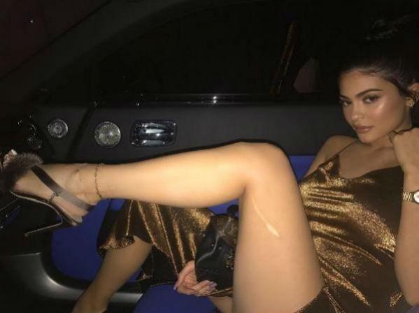 Kylie Jenner scar
