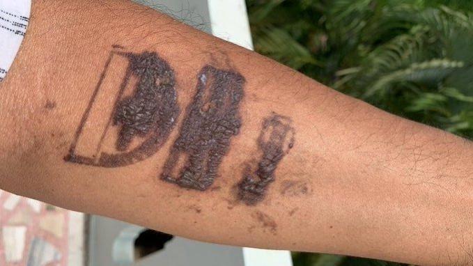 Picture posted by a Twitter user showing the reaction caused by stamping at the Delhi Airport scar