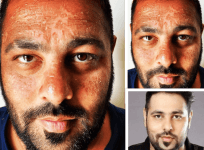 Badshah sunburn