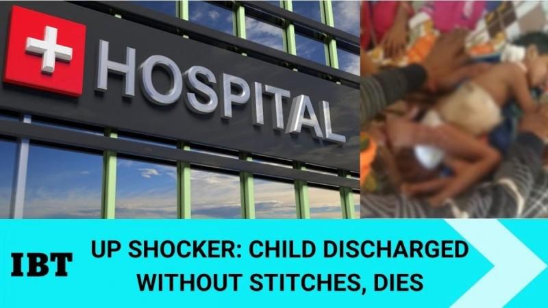 UP shocker