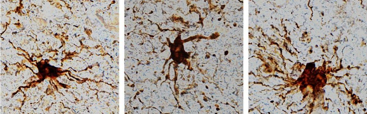'Zombie' cells come to life after the death of the human brain genes