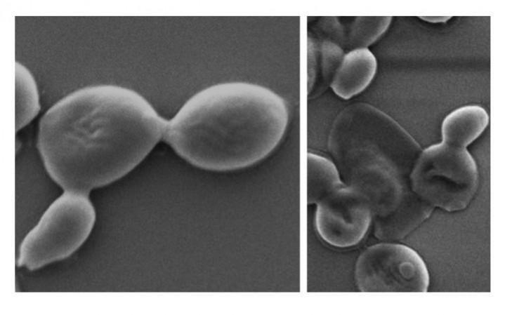 Candida auris