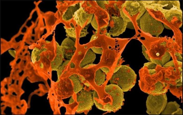 MRSA