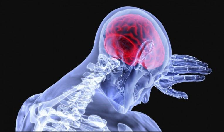 Brain Inflammation (Representational Picture) Brain
