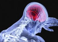 Brain