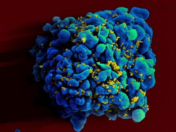 HIV Infected Cell (Representational Picture) HIV attacking cell