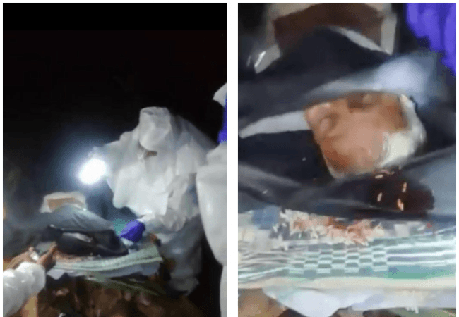 Fact check: What happened to elderly COVID patient with head injury in Sirsi; did doctors do it