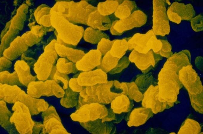 Haemophilus influenzae (Representational Picture) Haemophilus influenzae
