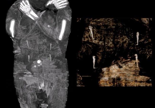 X-ray of the mummy Pregnant Mummy