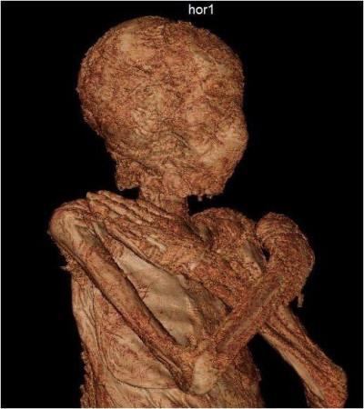 3D visualization of the mummy Pregnant Mummy