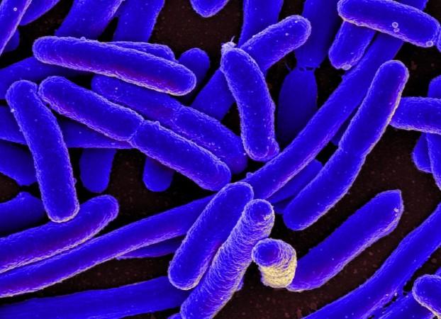 E.coli (Representational Picture) E.coli