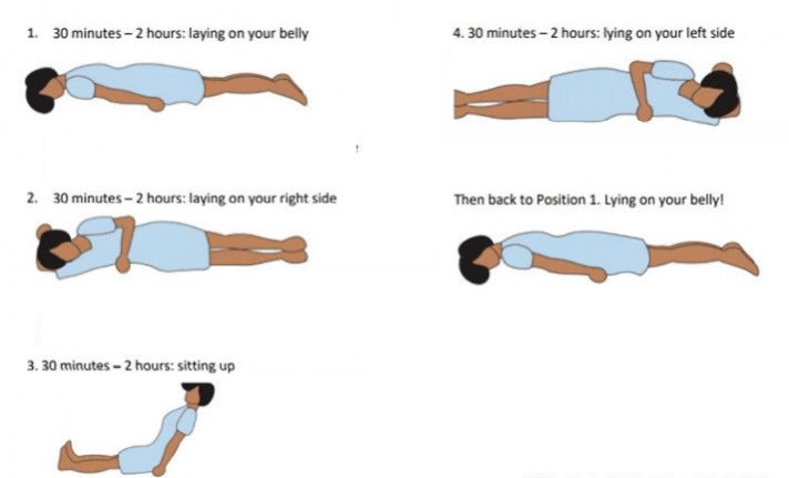 Proning positions Proning
