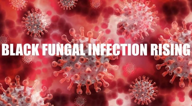Representational Image black fungal infection
