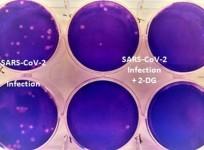 Coronavirus drug