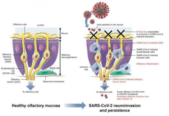 Diagram representing the various steps occurring in the sensory system and contributing to COVID-19-related anosmia Anosmia COVID-19