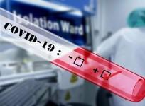 COVID-19 test