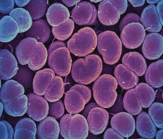 Neisseria gonorrhoeae bacteria (Representational Picture) Neisseria gonorrhoeae