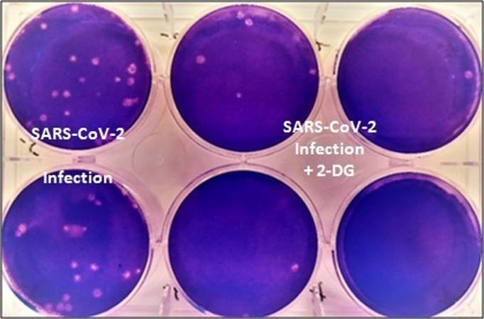 Cell cultures part of in vitro study of 2-DG 2-DG coronavirus