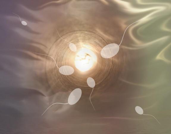 Sperms (Representational Picture) Sperm