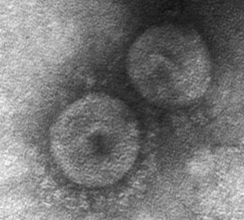 CCoV-HuPn-2018, newly identified canine-feline recombinant alphacoronavirus New Canine Virus