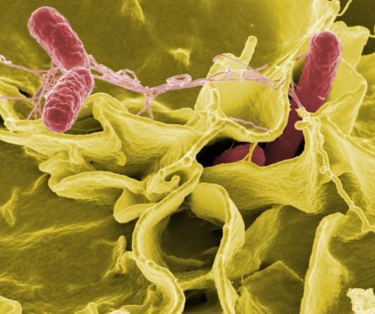 Salmonella Typhimurium (Representational Picture) Salmonella