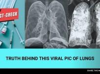Fact check: Truth behind viral photo of CT scans comparing lungs of COVID and vaccinated patients