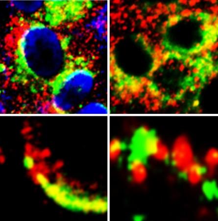 Images of cells showing close proximity (yellow) of GRP78 (green) with Spike protein of SARS-Cov-2 (red) (left panels) and ACE2 (red) (right panels) GRP78