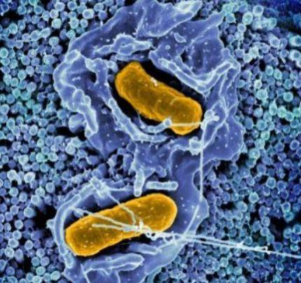 Scanning electron micrograph of Salmonella Typhimurium invading a human epithelial cell Salmonella